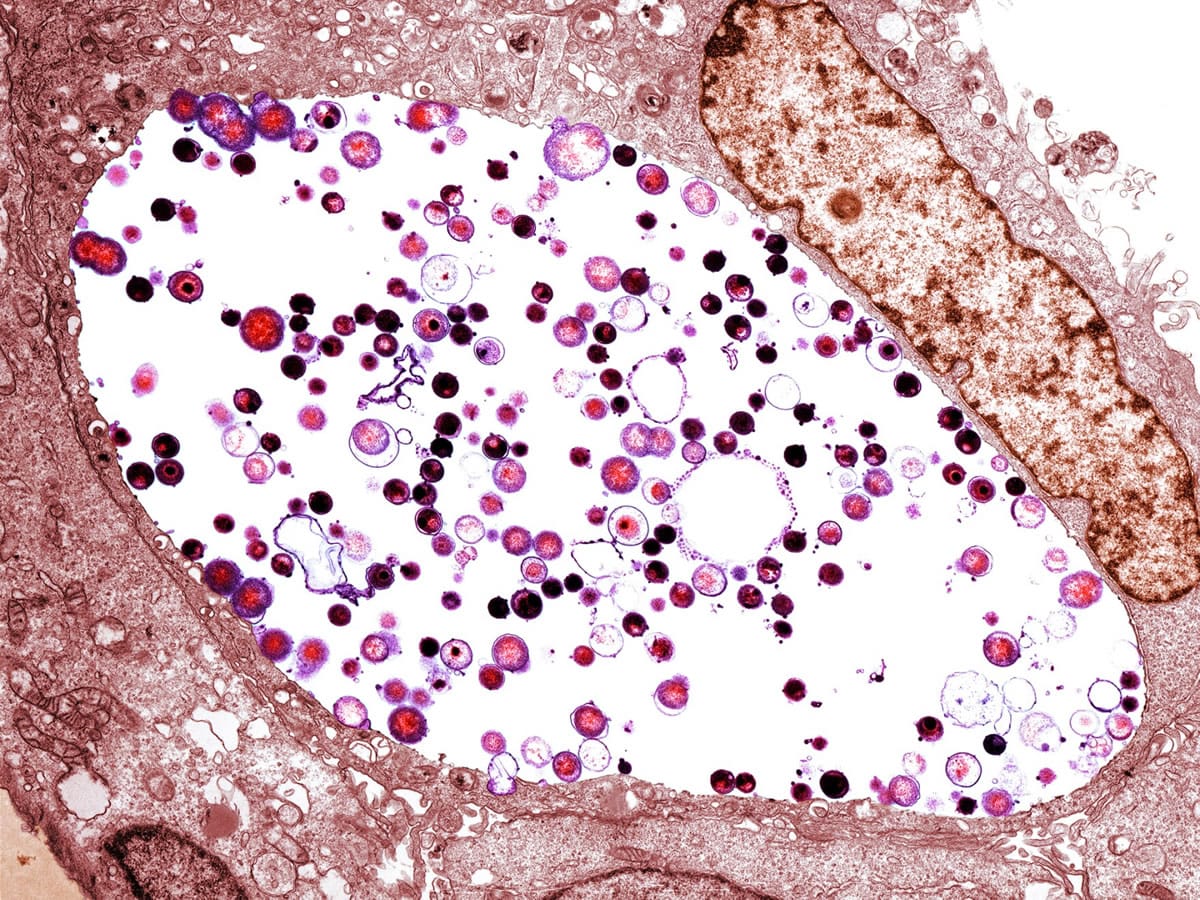 کلامیدیا چیست