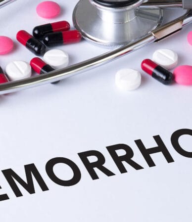 هزینه جراحی هموروئید در فردیس