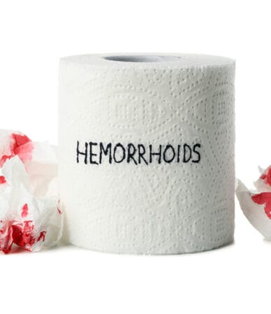 هزینه جراحی بواسیر با لیزر در قرچک