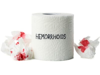 هزینه جراحی بواسیر با لیزر در قرچک