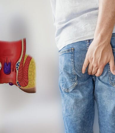 هزینه جراحی هموروئید با لیزر در ورامین