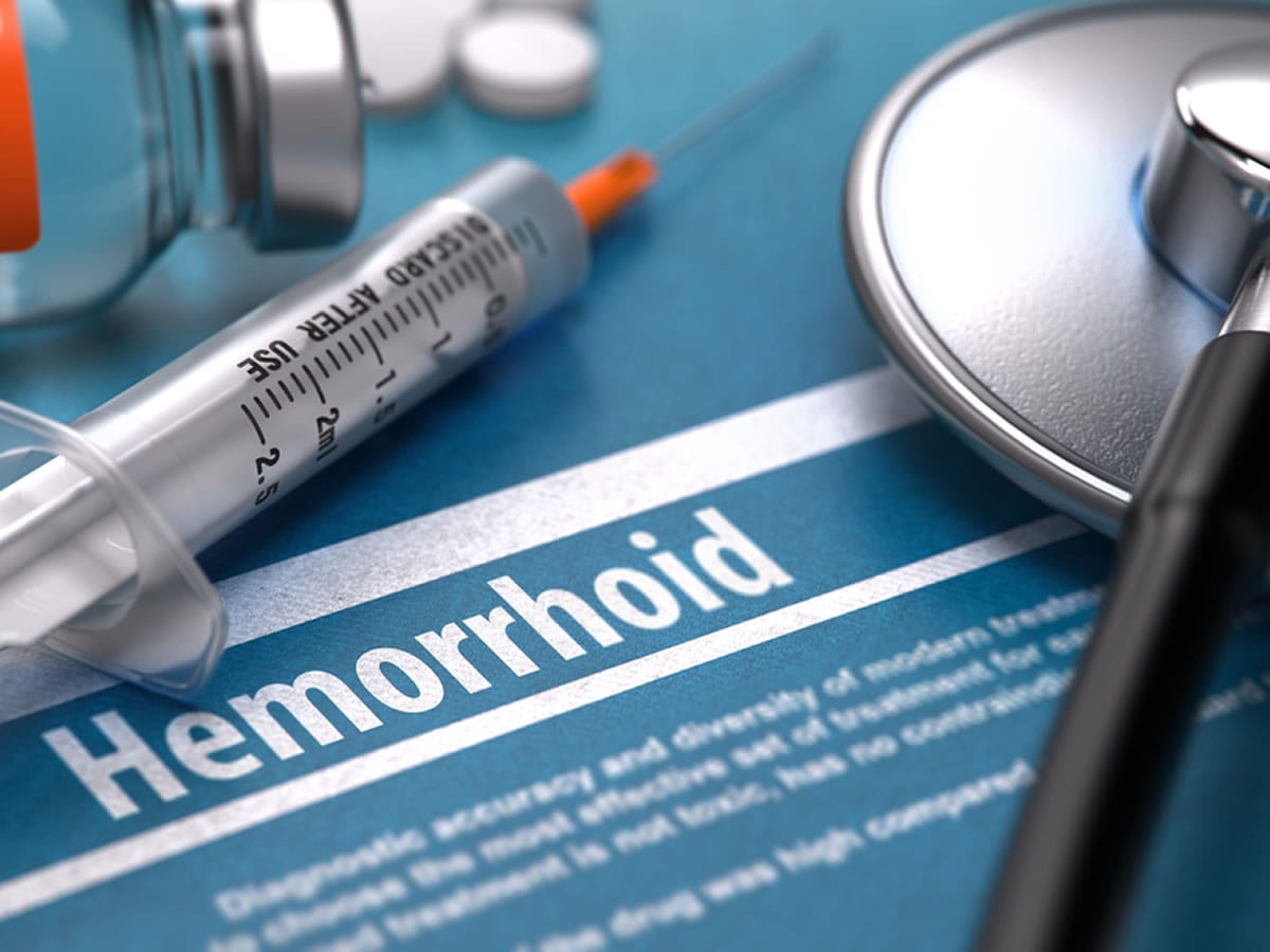 هزینه جراحی هموروئید با لیزر در دماوند