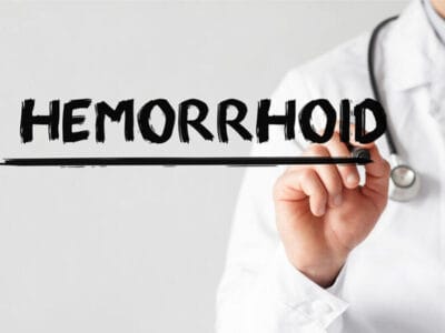 هزینه جراحی هموروئید با لیزر در ملارد