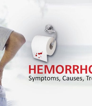 کلینیک لیزر هموروئید در تهران