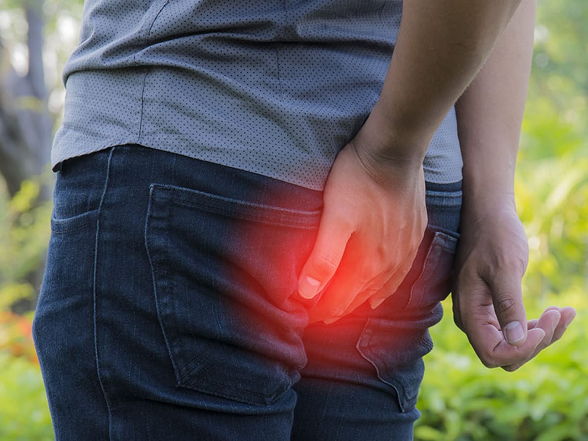 جراحی هموروئید با لیزر در امام حسین