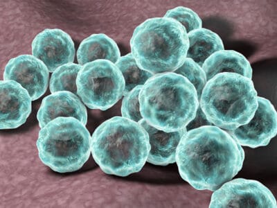 درمان زگیل تناسلی