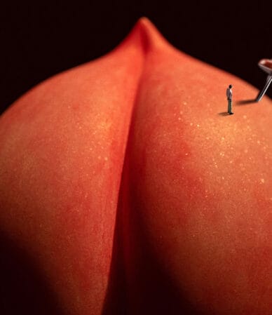 کلینیک هموروئید گرگان