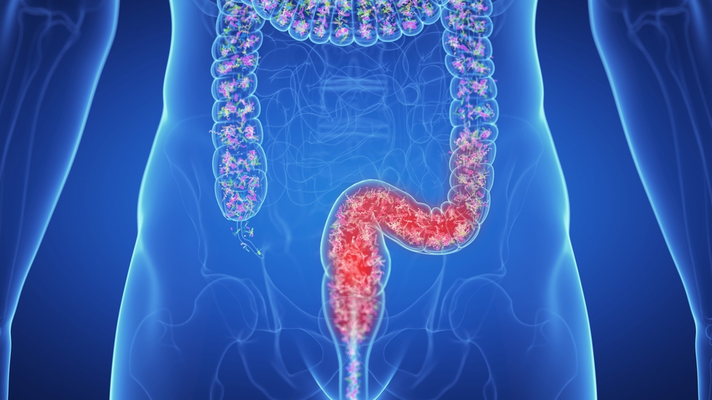عوارض خطرناک درمان نکردن یبوست و خشکی مزاج