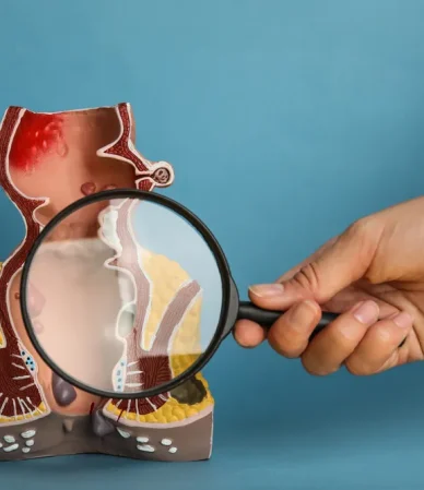 شقاق مقعدی: علائم، علل، درمان و پیشگیری