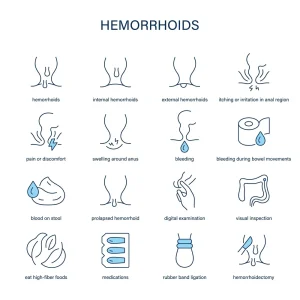 انواع درمان های بواسیر؛ بدون جراحی
