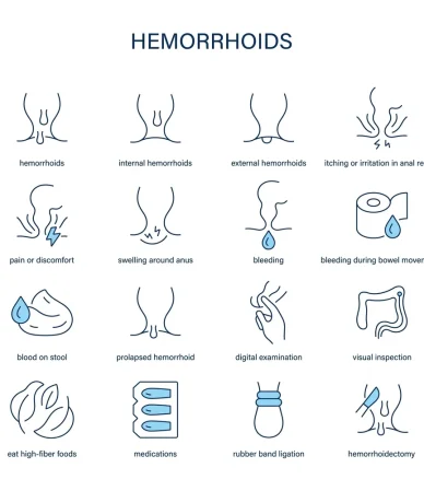 انواع درمان های بواسیر؛ بدون جراحی