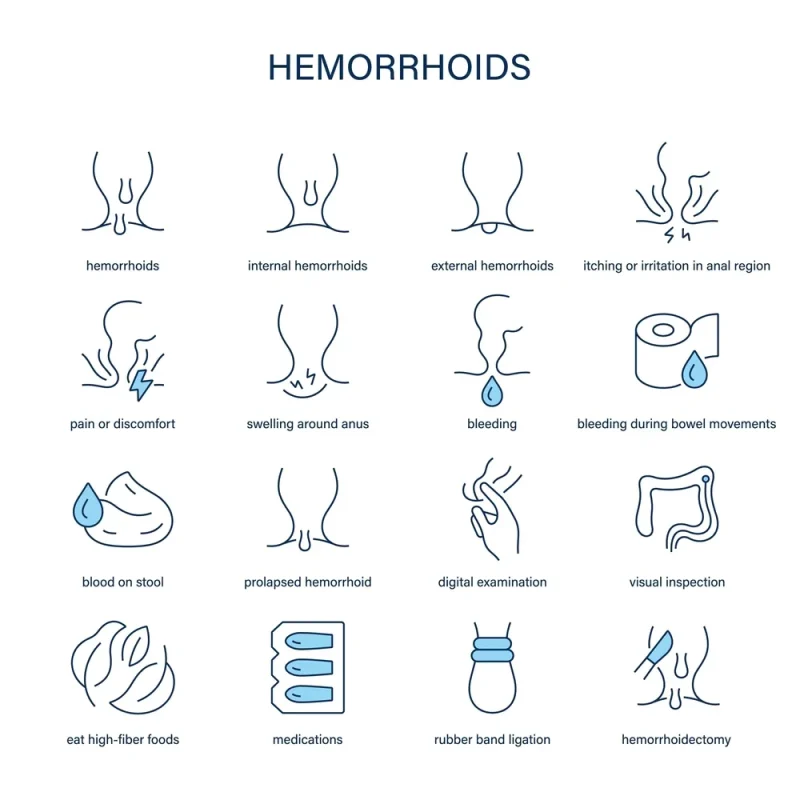 انواع درمان های بواسیر؛ بدون جراحی