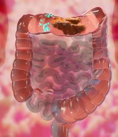 یبوست؛ از اولین نشانه تا علائم خطرناک