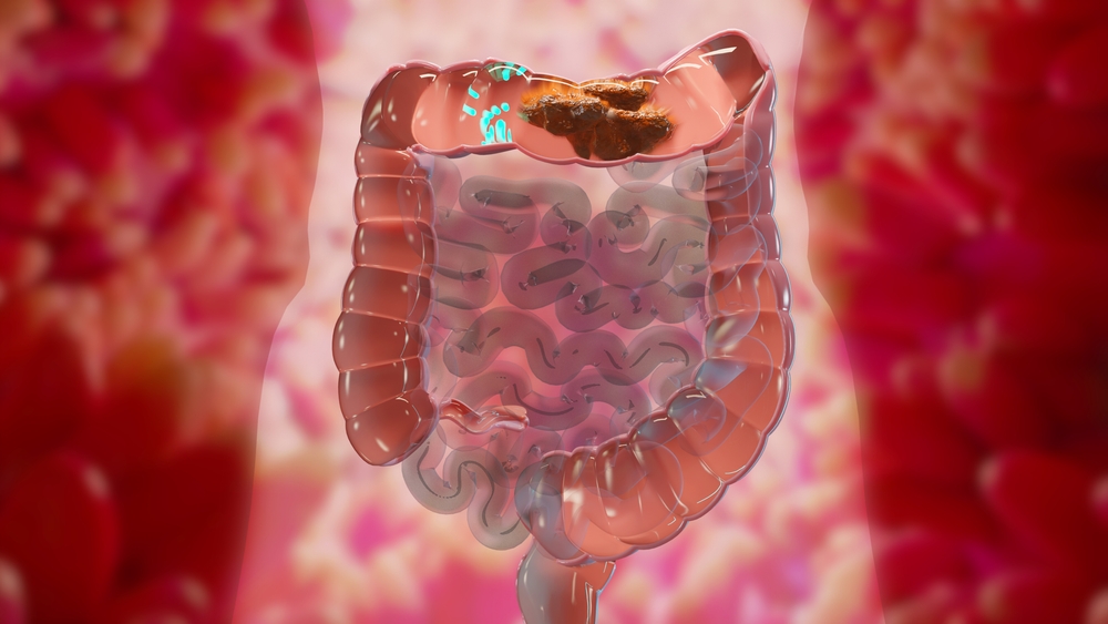 یبوست؛ از اولین نشانه تا علائم خطرناک