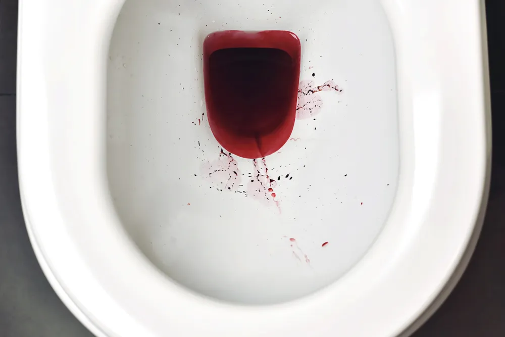 علل خونریزی مقعدی هنگام دفع و بدون دفع