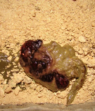 خون در مدفوع: بررسی نشانهها و خطرات