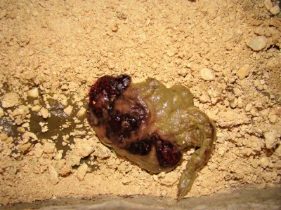 خون در مدفوع: بررسی نشانه‌ها و خطرات