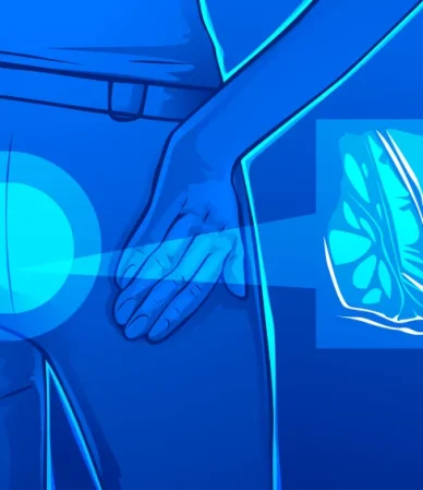 آبسه مقعدی:از دلایل، عوامل تا تشخیص و درمان