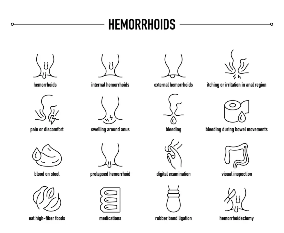بواسیر یا هموروئید؛ از علل تا درمان