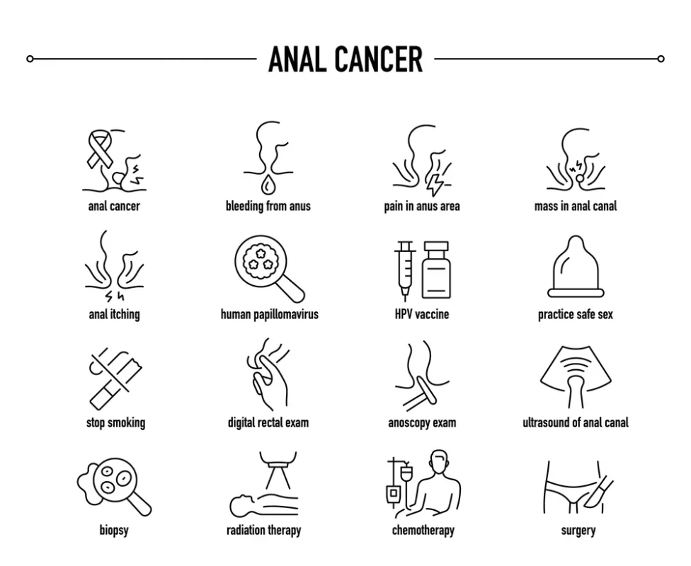 علل و مکانیسمهای ایجاد سرطان مقعد