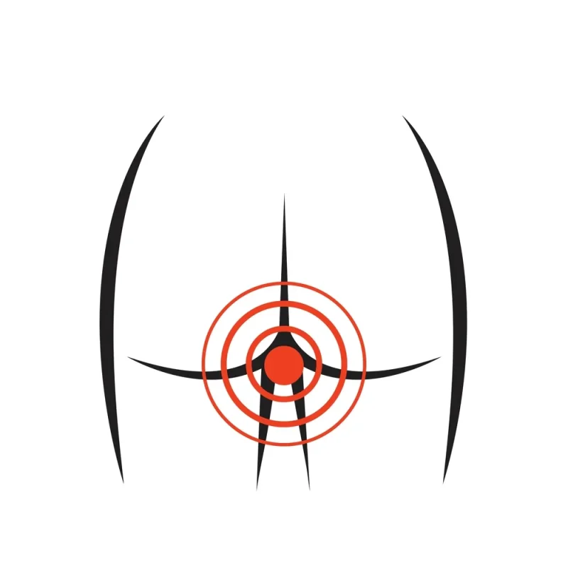 بررسی تفاوت‌های آبسه مقعدی و فیستول مقعدی