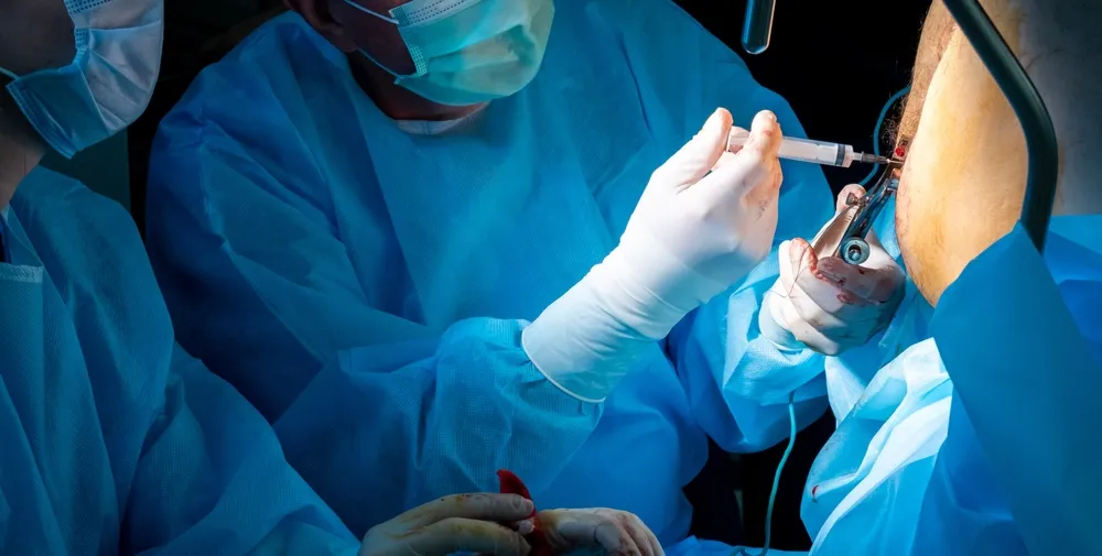 عمل جراحی شقاق یا فیشر مقعد: از روش ها تا انجام