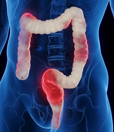 خونریزی گوارشی: شناخت، علل و علائم