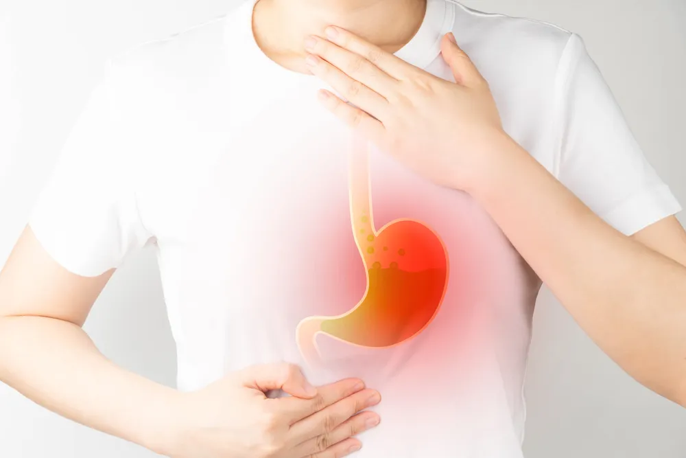 سوزش معده و رفلاکس اسیدی
