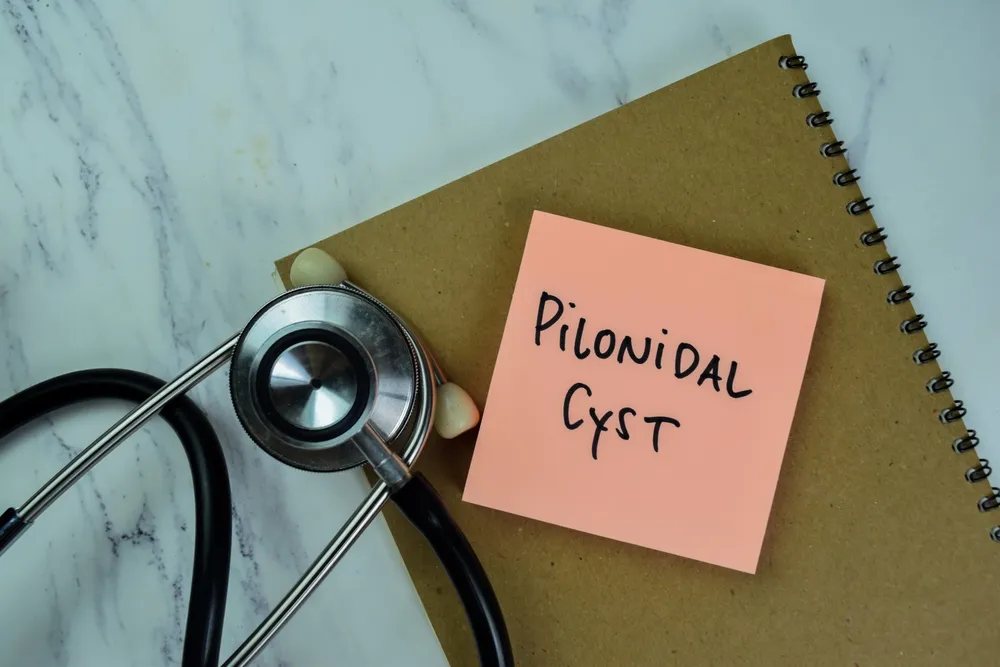 درمان خانگی کیست مویی بدون نیاز به جراحی