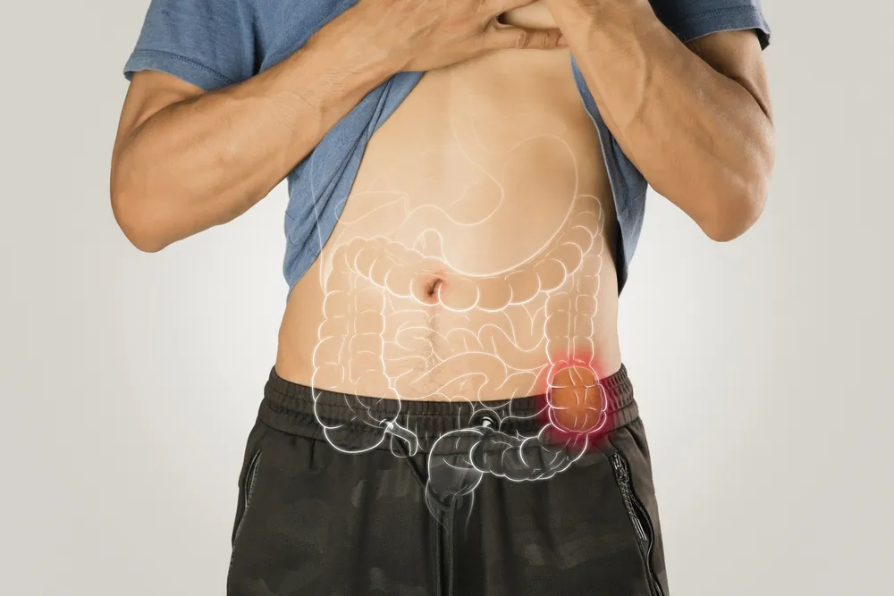 انسداد روده بزرگ و تأثیر آن بر عملکرد گوارش