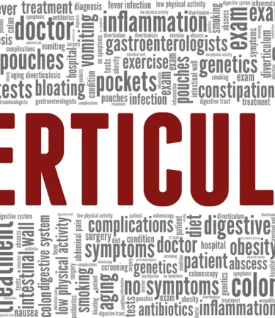 دیورتیکولیت: از علل و علائم تا درمان