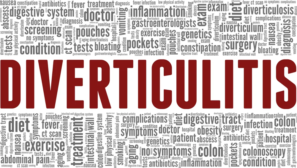 دیورتیکولیت: از علل و علائم تا درمان