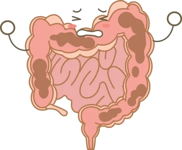 تخلیه و پاکسازی روده