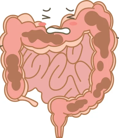تخلیه و پاکسازی روده