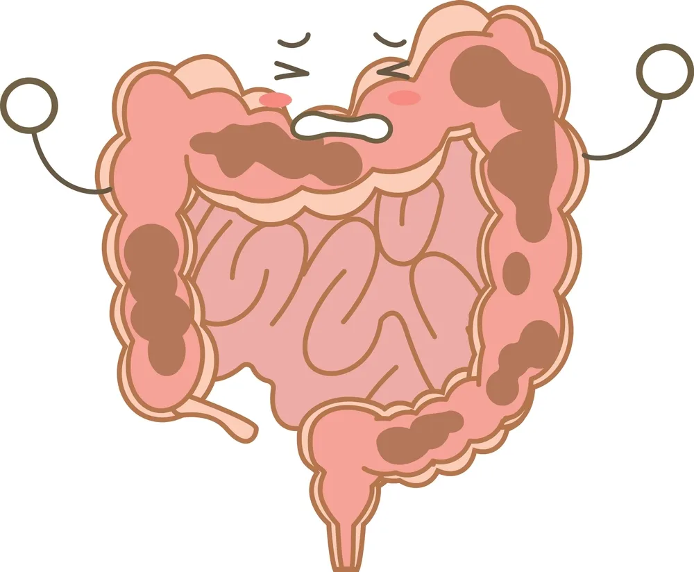 تخلیه و پاکسازی روده