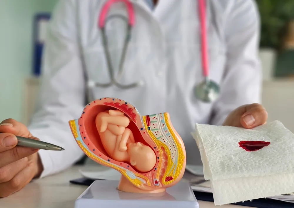 آسیب‌های زایمانی مرتبط با فیستول